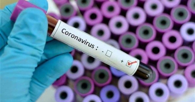 Powiat wesprze zakup aparatury do wykonywania testów na obecność koronawirusa
